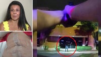 Richardson bartender still recovering after May stabbing attack