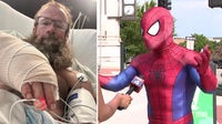 Friendly Denton County Spider-Man recovering after near-fatal snake bites