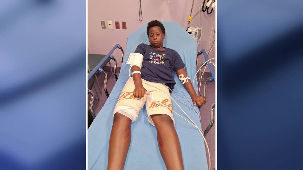 Dallas police search for gunman after stray bullet hits 10-year-old sleeping in apartment