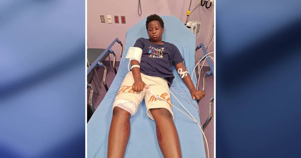 Dallas police search for gunman after stray bullet hits 10-year-old ...