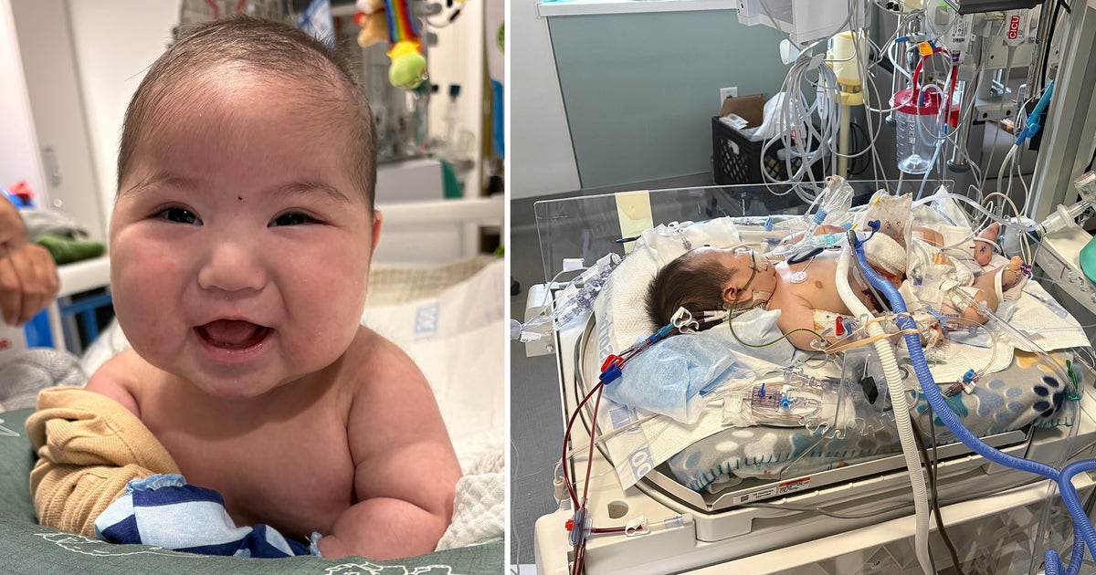 Dallas firefighter's 4-month-old baby returns home after extended health scare