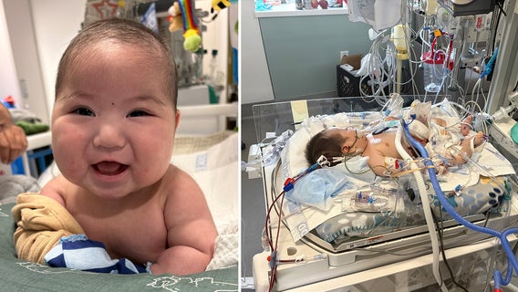 Dallas firefighter's 4-month-old baby returns home after extended health scare