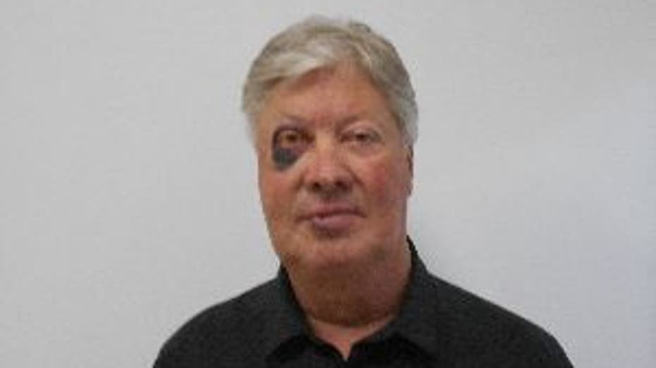 Former Gateway pastor Robert Morris’ sex offender photo features black eye — FOX 4 Dallas