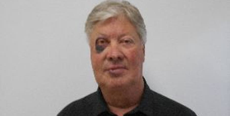 Former Gateway pastor Robert Morris’ sex offender photo features black eye