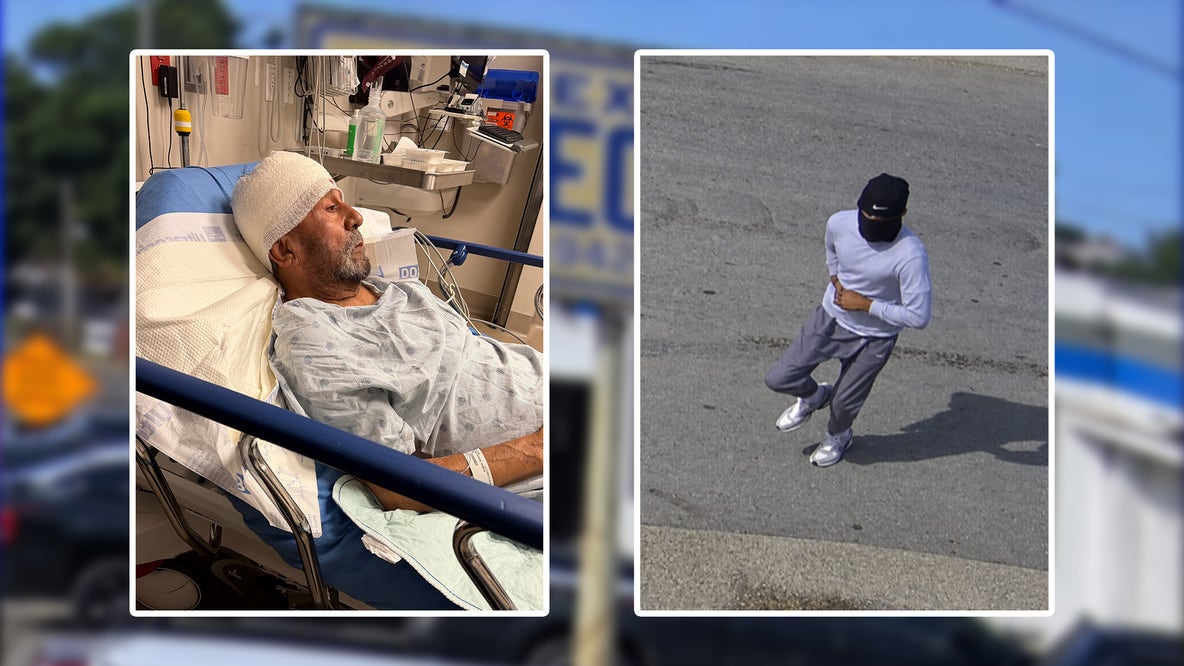 Dallas business owner pistol whipped during robbery, police search for suspect
