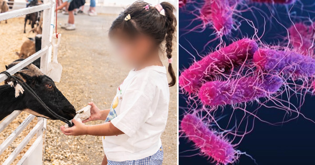 Image accompanying Dallas health officials investigating if E. coli cases came from State Fair of Texas petting zoo, from FOX 4 News Dallas-Fort Worth