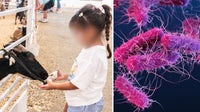 Dallas health officials investigating if E. coli cases came from State Fair of Texas petting zoo
