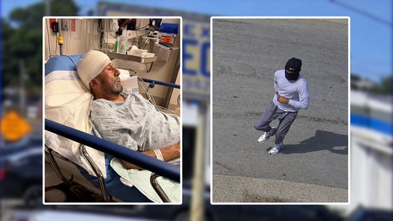 Dallas business owner pistol whipped during robbery, police search for suspect