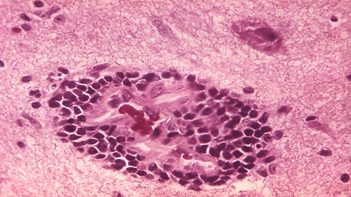 Stray cat tests positive for rabies in Athens-Clarke County