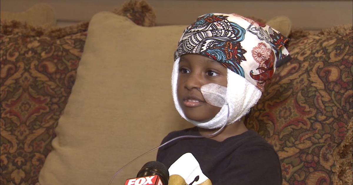 First responders celebrate young dog attack survivor | FOX 5 Atlanta