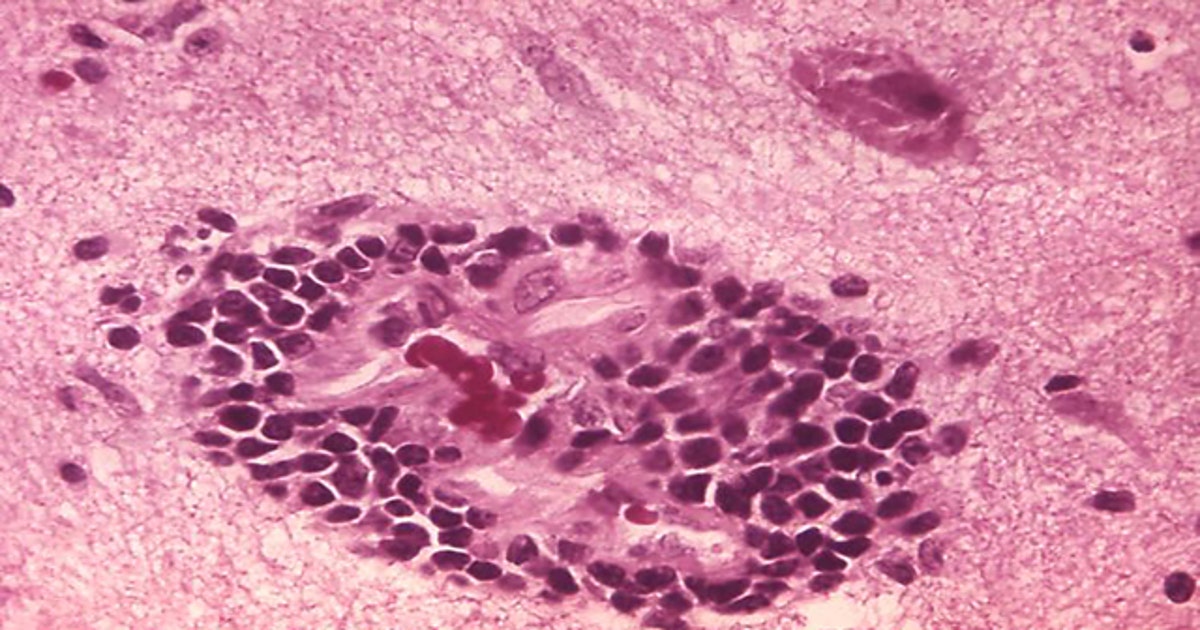 Stray cat tests positive for rabies in Athens-Clarke County