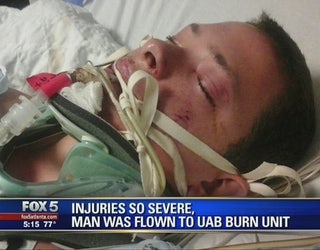 Cobb_County_Man_Severely_Injured_After_e_0_20150908015023