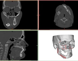 Kirby CAT scan_1460573489743.jpg