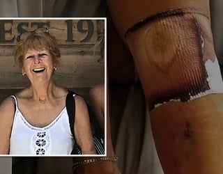 bacteria victim_1561758550469.jpg-401385.jpg