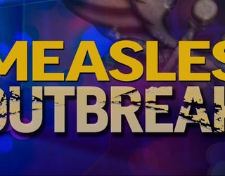 measles outbreak_1464909088351-408200.jpg