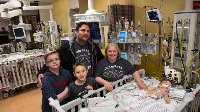 Conjoined identical twins successfully separated at Texas Children's Hospital
