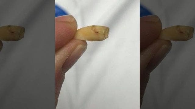 Human tooth found in bag of Planters cashews, woman says