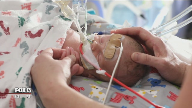 Premature baby makes whirlwind trip for lifesaving surgery in St. Pete
