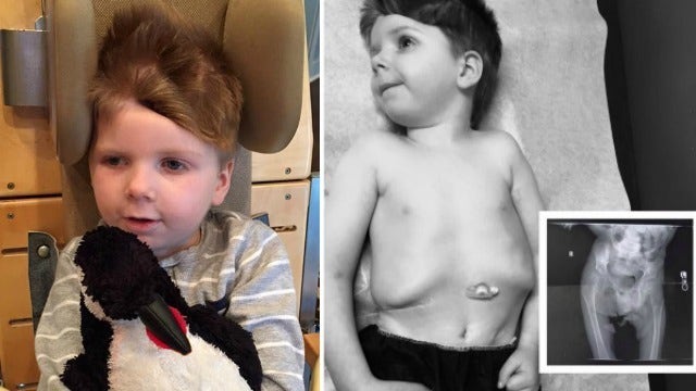 Tripp Halstead Not Feeling Well Days before Hip Surgery