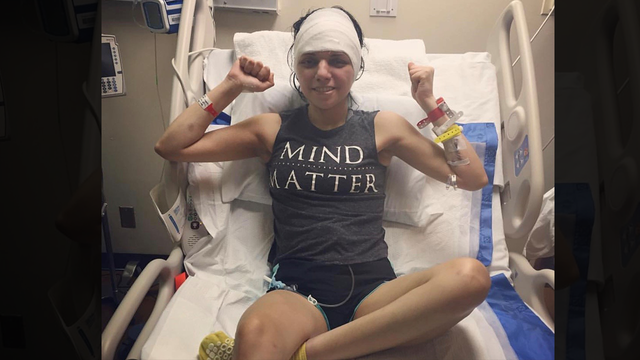 Woman survives 6 brain surgeries while studying to be a doctor