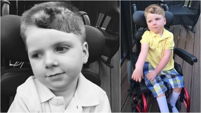 Tripp Halstead gets haircut ahead of skull surgery