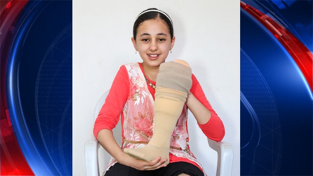 Injured refugee girl gets a new leg in Atlanta