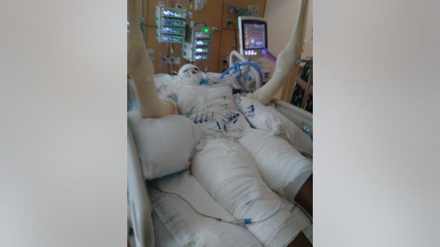 12-year-old Detroit girl severely burned attempting 'fire challenge'