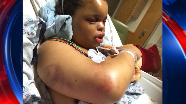 Wife and mother brutally beaten and held captive talks to FOX 5