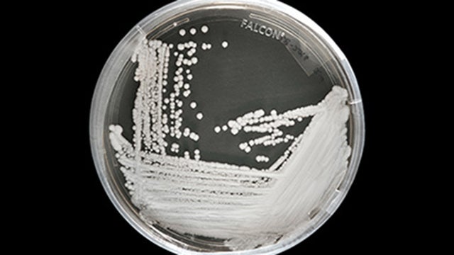 CDC: Deadly, drug-resistant fungus spreading through hospitals