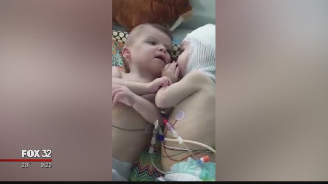 Former conjoined twins say ‘dada' in latest video