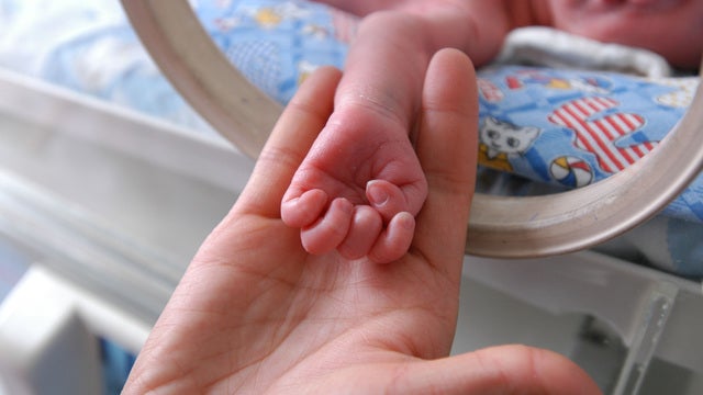 Rest in peace, Marcus: Baby boy dies while waiting for partial liver transplant