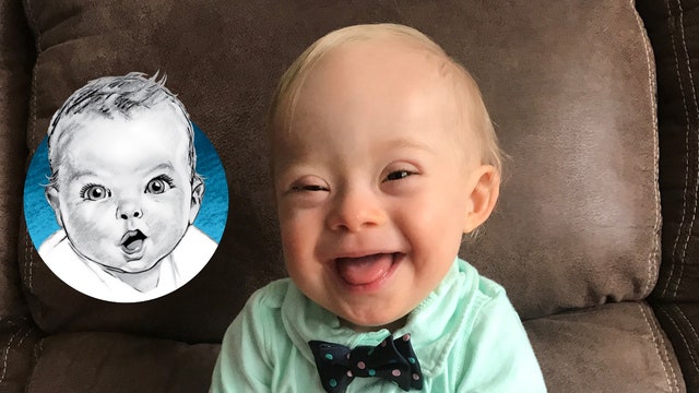 2018 Gerber baby celebrates 2nd birthday