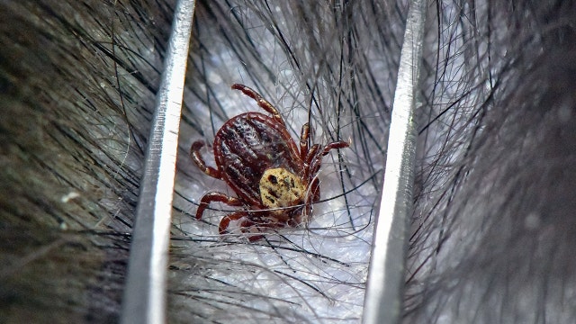 Tick bites leave 5-year-old girl hospitalized, unable to swallow or move amid ‘tick paralysis'
