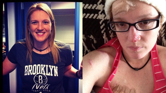 'I got back up 87 times': Woman recovers from 86 skin cancer surgeries, sends message of hope