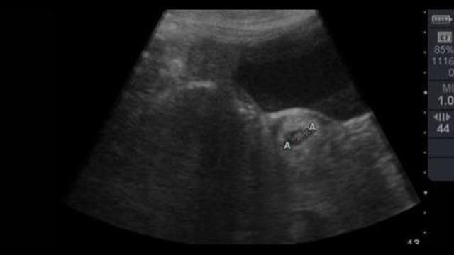 Lun Lun the giant panda is expecting at Zoo Atlanta
