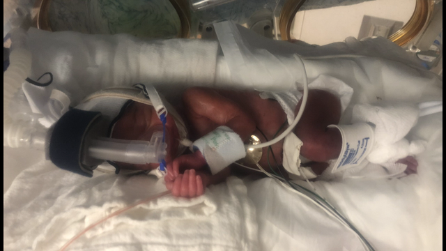 Family of 3-month-old girl in NICU hopes she'll be home for Christmas