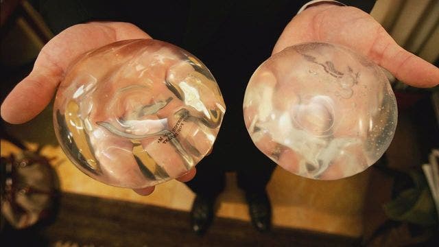 FDA alerts doctors of rare cancer with breast implants