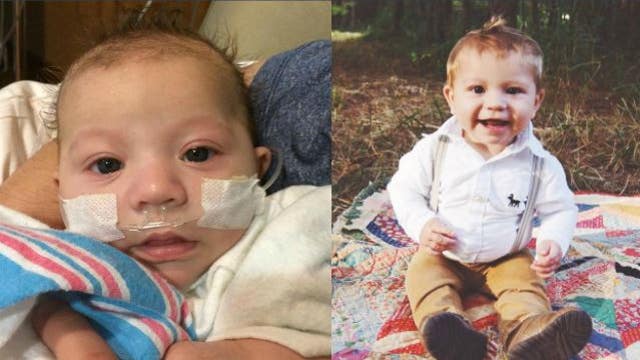 Georgia baby born with bacterial meningitis thriving