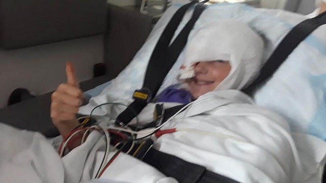 Freak lawnmower accident leaves girl with 200 stitches down middle of face