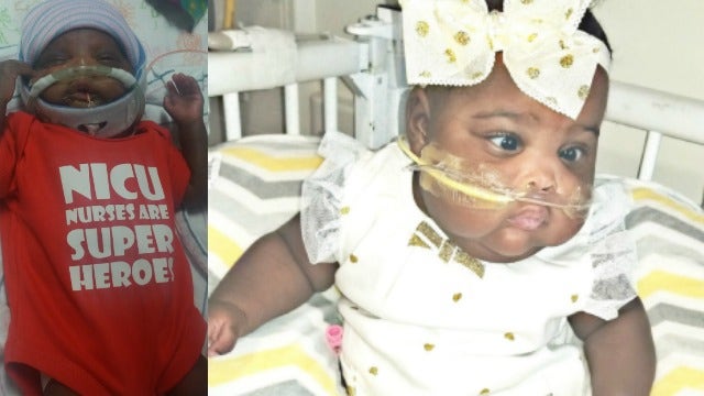Cobb County baby released from hospital after 7 months
