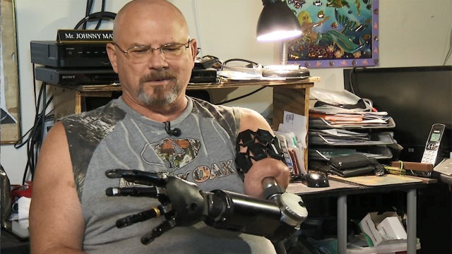 Florida man tests world's first fully mind-controlled artificial arm