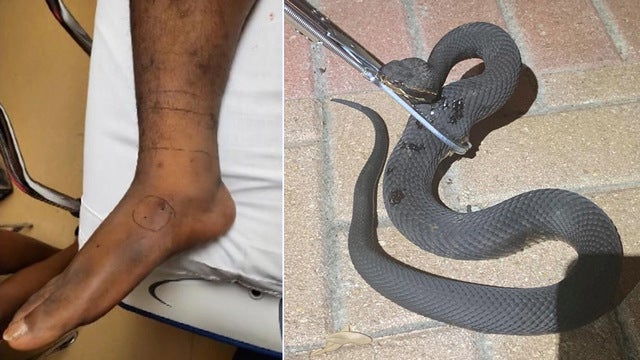 Florida man bitten by venomous snake outside of home