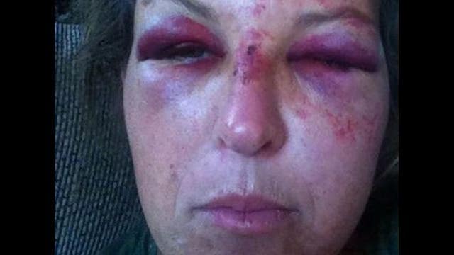 Daycare Owner Attacked With Shovel Protecting Kids