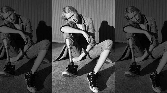 Model who lost leg from tampon-induced toxic shock could also lose the other