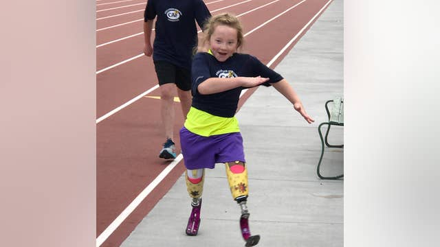 Lilly's new legs: Santa Rosa 9-year-old regains confidence after fire claims prosthetics