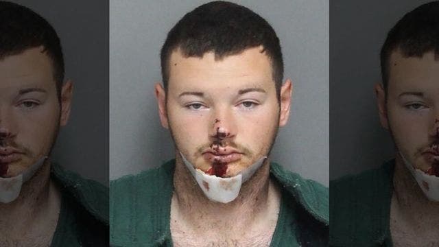 Man kills horse, shoots self in face