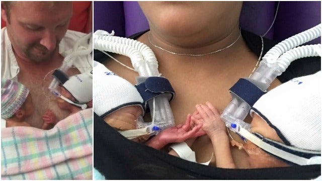Video Goes Viral of Preemie Twins Holding Hands