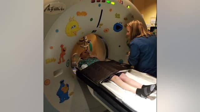 6 cases of rare polio-like illness confirmed in Minnesota