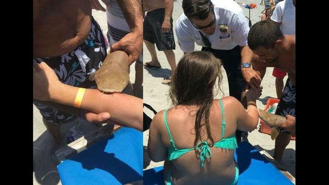 Woman taken to hospital with shark still attached to her arm