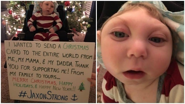 Boy Missing Part of Brain Shares Touching Christmas Card